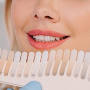 blanqueamiento dental
