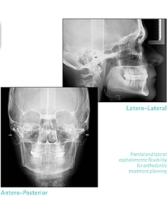 Clinica dental Tudela radiografia Lateral