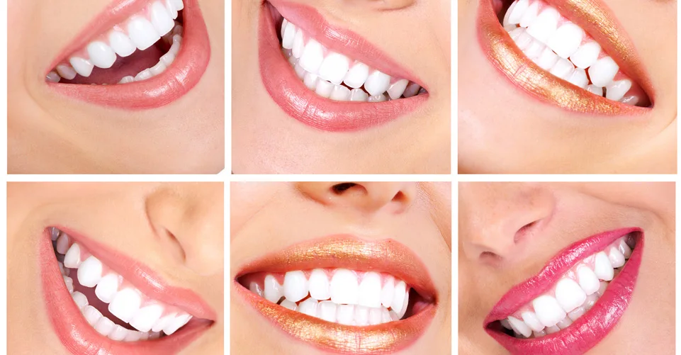 bocas bonitas dentista en Tudela