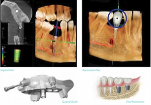 dentista en tudela cbct escaner 3d dental