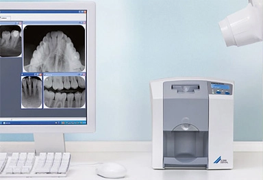 tecnologia-radiologia-periapical digitalizada dentista mockupdental Tudela